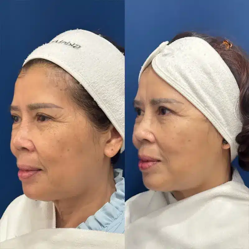 42214447114144414614141114