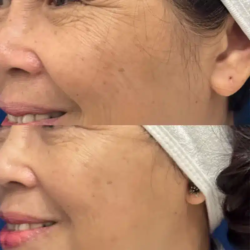 4221444714114144414614141114