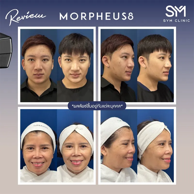 422144471411414441461414141114