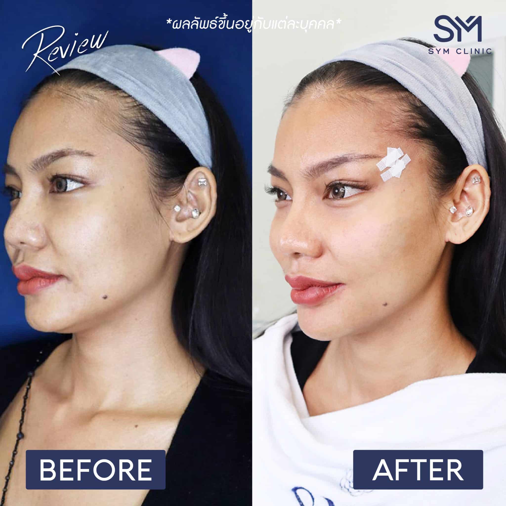 review foxy web-04-02