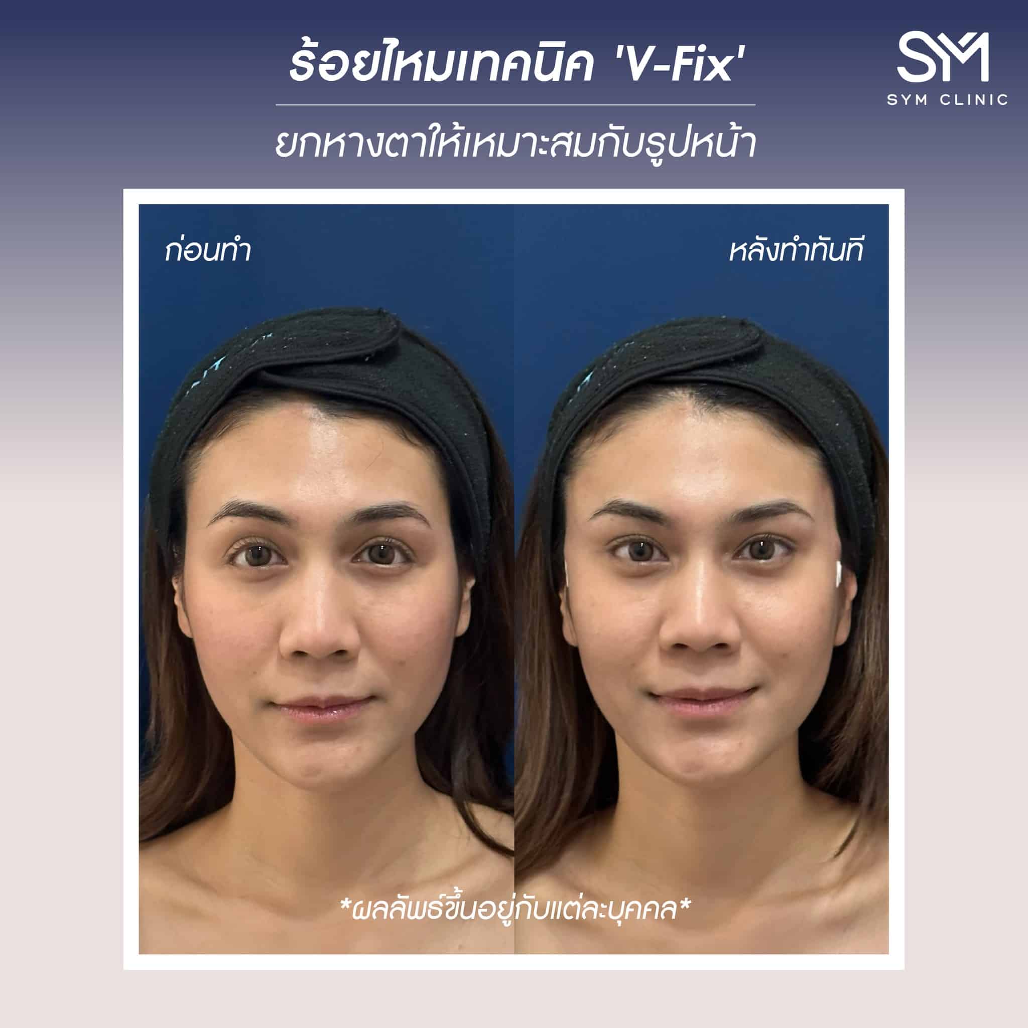 reviewร้อยไหม1