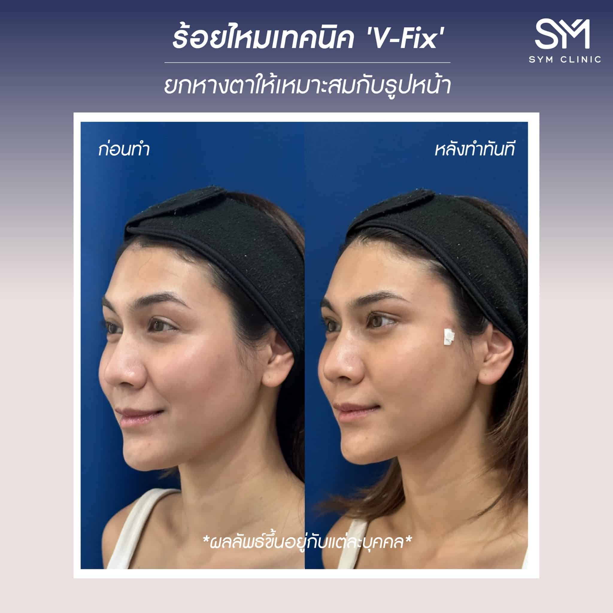 reviewร้อยไหม3