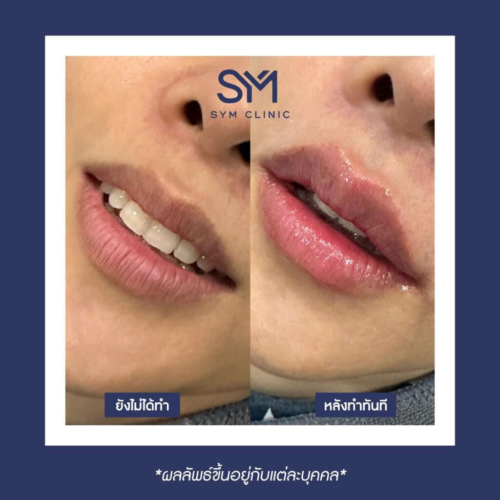 386467099_892873069074838_8385769935759618210_n