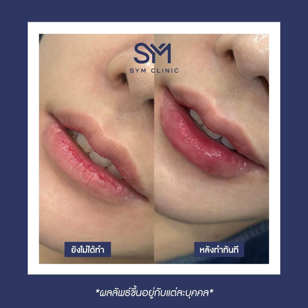 387042123_892873005741511_2512880116143168649_n