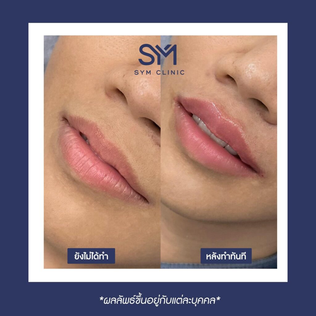 387796732_892872929074852_2400872641091104621_n