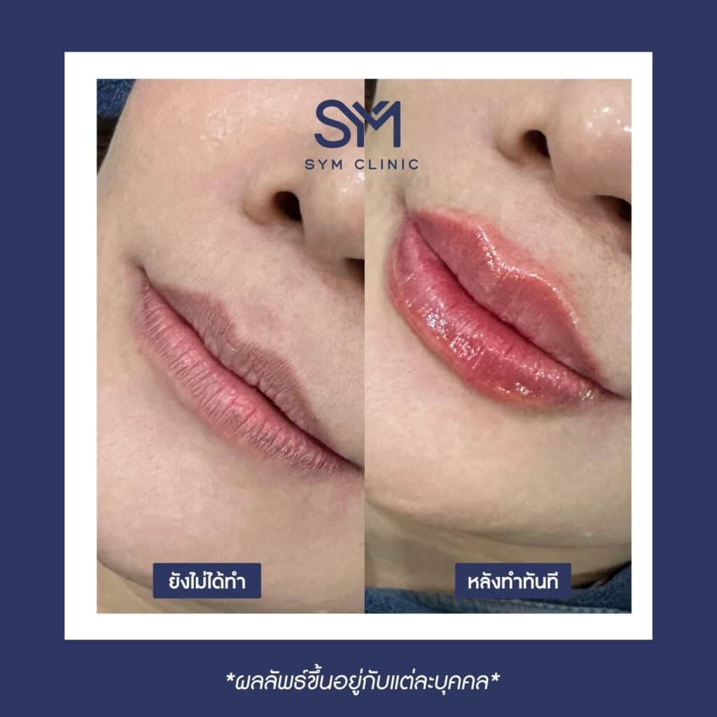 387808933_892873052408173_3106425732232099143_n