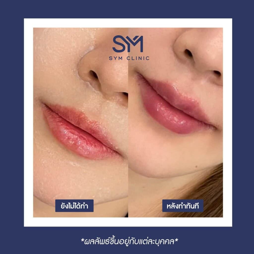 387830399_892872955741516_4919157677085039111_n